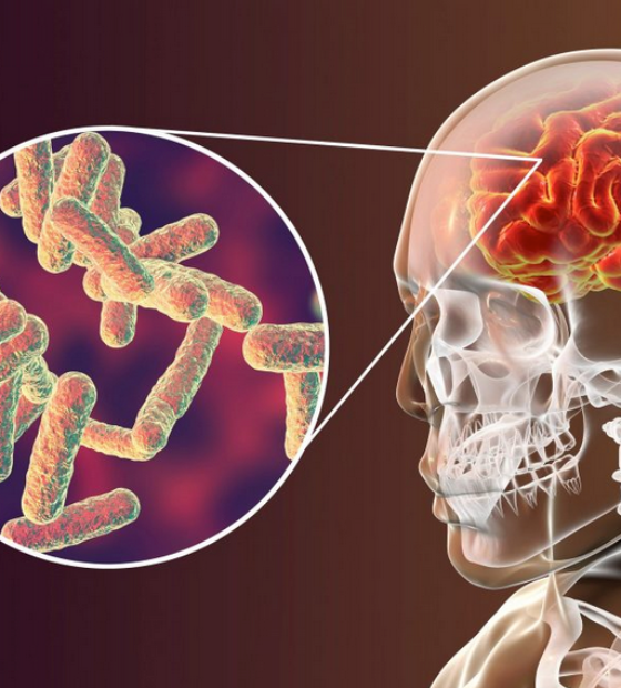 Órgãos de saúde do estado alertam para surto de meningite