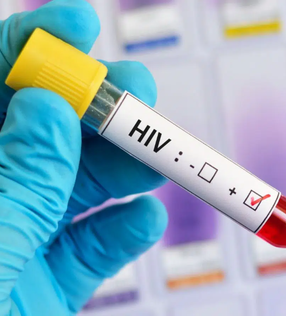 Número de casos de HIV sobe no Brasil; mortalidade é a menor em dez anos