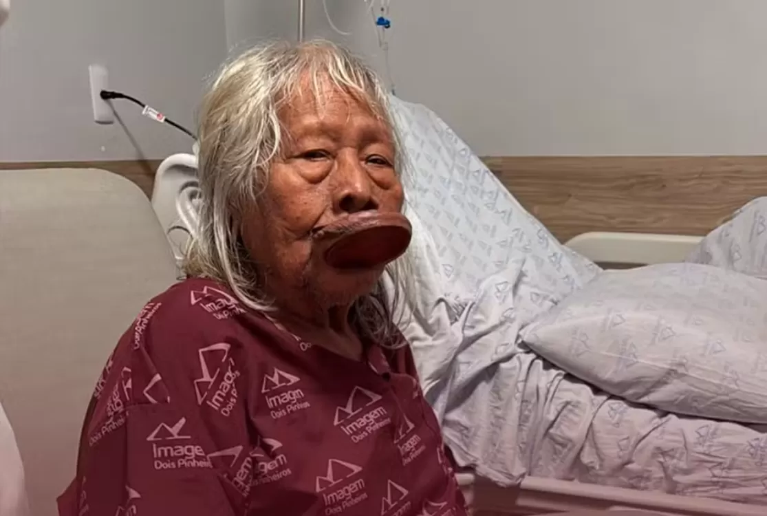 Cacique Raoni é diagnosticado com câncer aos 94 anos e recebe cuidados paliativos